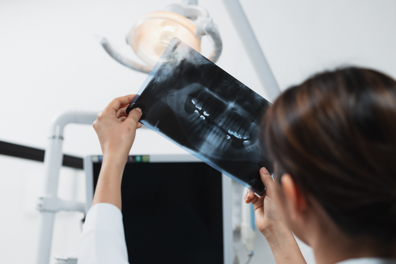 Female Dentist Examining Dental X-ray